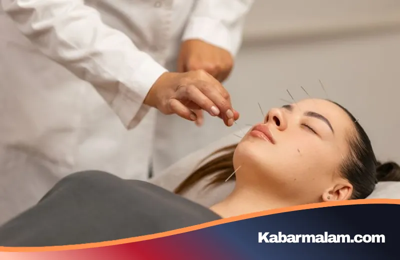 Akupuntur Wajah: Rahasia Kecantikan Alami yang Kini Geser Popularitas Botox dan Filler