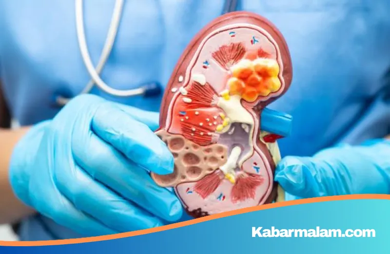 Alarm Darurat Gagal Ginjal di Malaysia: Akankah Menjadi Ledakan Kasus di Masa Depan?