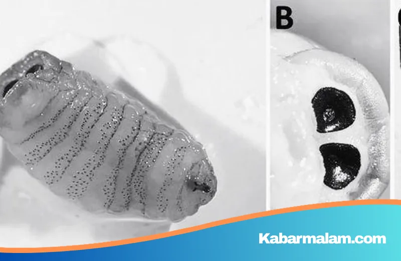 Geger! Batuk Parah Berujung Temuan Larva Lalat yang Bersarang di Hidung, Kasus Medis Langka yang Mencengangkan