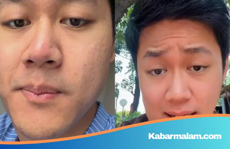 Perjuangan Jeje Adriel Melawan Kanker Limfoma Hodgkin di Usia 25 Tahun: Waspadai Gejala dan Faktor Risikonya