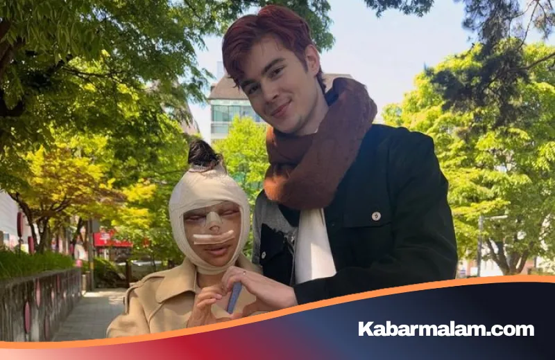 Tekanan Standar Kecantikan: Kisah Haru Pugun Jalani Operasi Plastik Demi Imbangi Suami 'Mirip Cha Eun Woo'