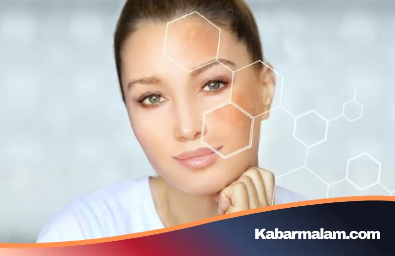 Wajah Sering Merah? Jangan Keliru, Ini Beda Rosacea dan Kulit Sensitif yang Wajib Anda Tahu
