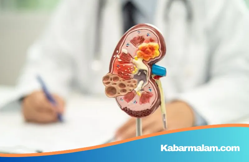 Waspada Lonjakan Kanker Ginjal di Usia Muda, Kenali Gejala 'Senyap' yang Sering Diabaikan