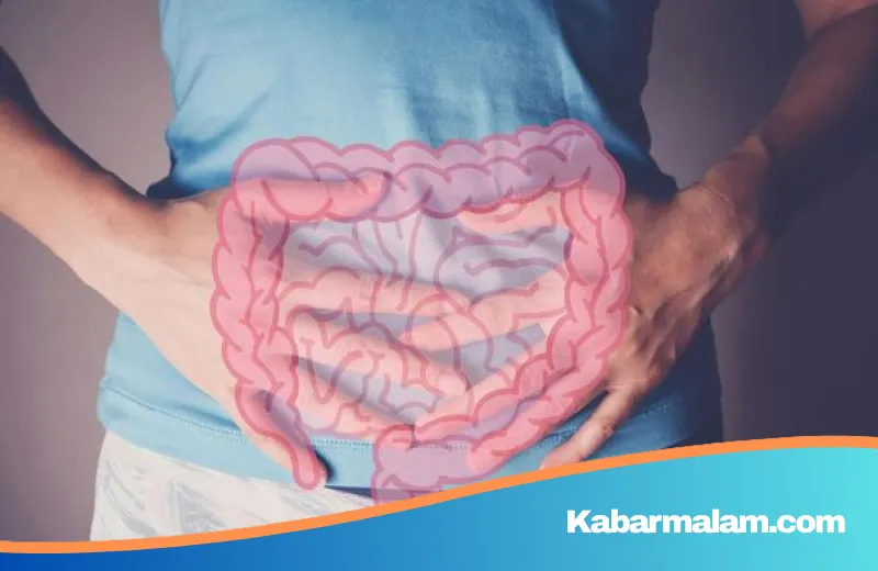 Gen Z Wajib Waspada! Pakar UI Ungkap Gejala Pencernaan yang Bisa Memicu Kanker Usus Besar