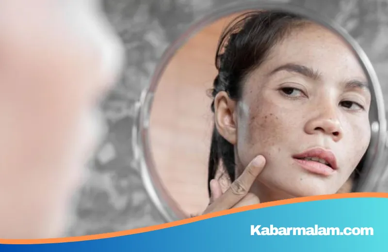 Jangan Abaikan Bercak di Wajah, Kenali Perbedaan Flek Hitam Biasa dan Gejala Kanker Kulit
