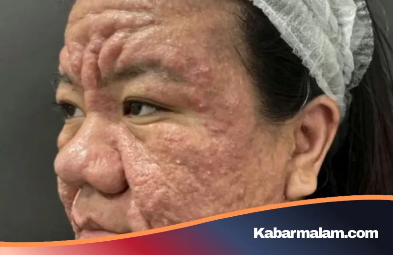 Kisah Haru Farah: Perjuangan Melawan Perubahan Wajah Ekstrem Akibat Hormon Kehamilan yang Viral