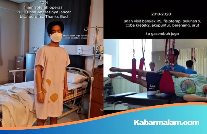 Kisah Inspiratif Charis Nicholas: Perjuangan Panjang Melawan Saraf Kejepit Akibat Cedera Basket yang Nyaris Melumpuhkan