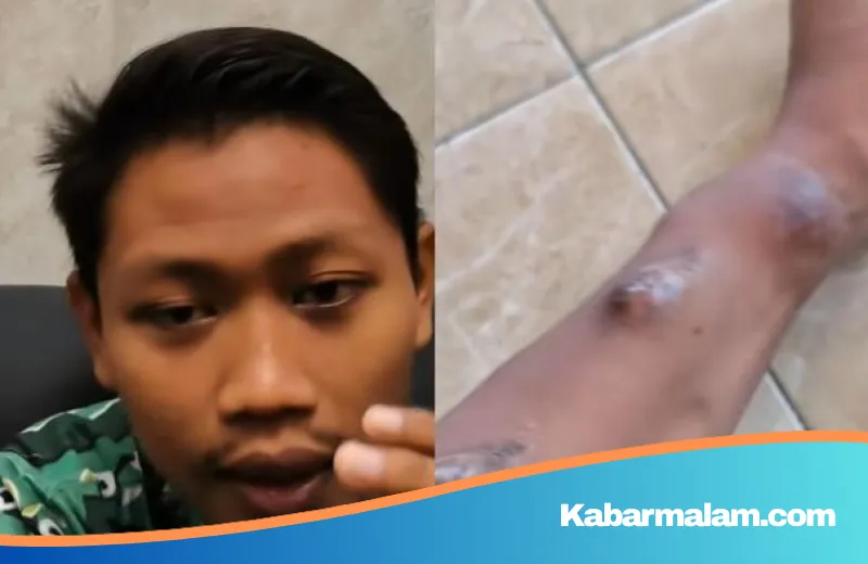 Pelajaran Berharga dari Tuban: Kisah Pemuda 26 Tahun yang Terjebak Ritual Cuci Darah Akibat Mi Instan