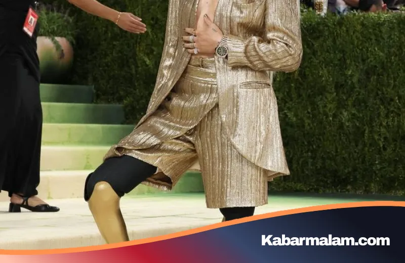 Pesona 'Gadis Berkaki Emas' di Met Gala: Tragedi di Balik Keanggunan Lauren Wasser