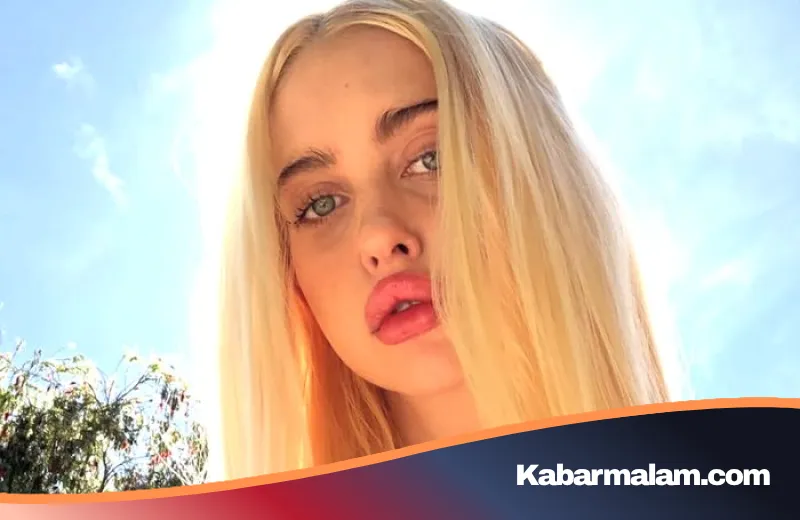 Rahasia Kecantikan Chloe Cherry: Dari 'Kecanduan' Filler Bibir Hingga Abaikan Rasa Sakit Tanpa Anestesi