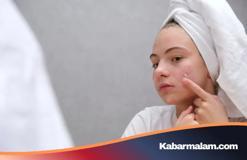 Rahasia Perawatan Tepat untuk Kulit Sensitif, Berminyak, dan Berjerawat Tanpa Iritasi