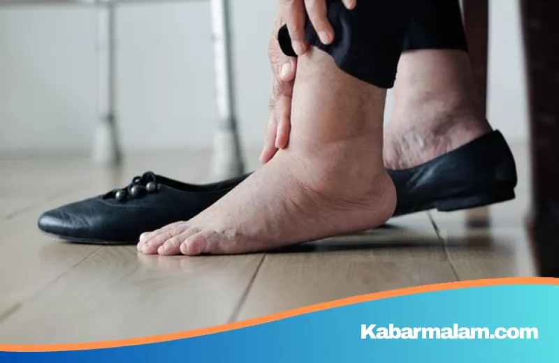 Sering Dianggap Kelelahan Biasa, Ternyata Perubahan di Pergelangan Kaki Ini Tanda Ginjal Rusak