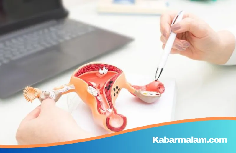 Silent Killer yang Sering Terabaikan: Mengenal Gejala dan Pentingnya Deteksi Dini Kanker Serviks
