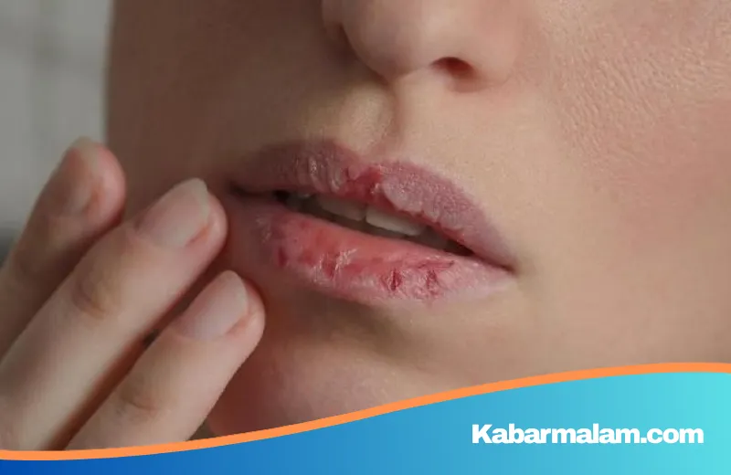 Studi Terbaru: Hubungan Tak Terduga Bakteri Mulut Terhadap Risiko Kanker Lambung