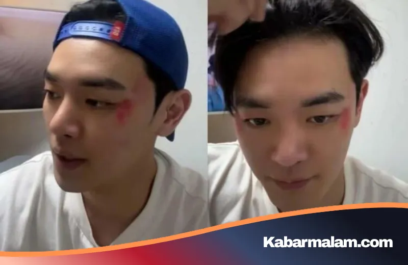 Tragedi di Balik Layar: Jang Dong Joo Pensiun Dini Akibat Teror Utang dan Ancaman Fisik