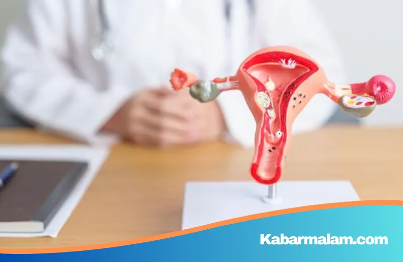 Transformasi PCOS Menjadi PMOS: Membedah Makna di Balik Perubahan Nama dan Dampaknya bagi Kesehatan Wanita