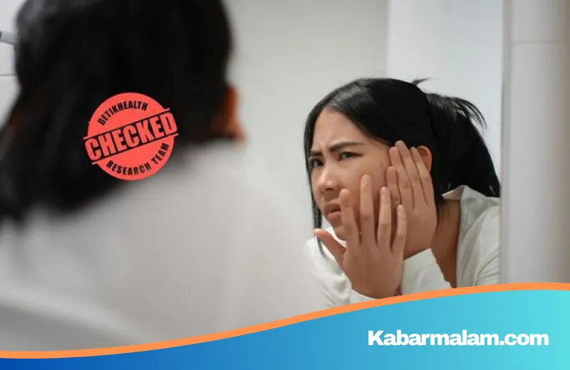 Wajah Masih Berjerawat Meski Rajin Cuci Muka? Kenali Daftar Makanan Pemicu 'Breakout' yang Sering Diabaikan