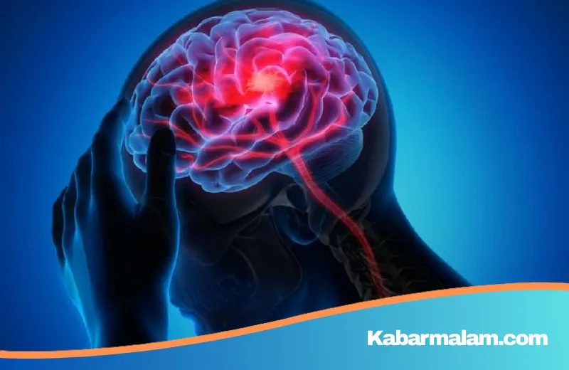 Waspada Silent Killer! Dokter Saraf Ungkap Ancaman Stroke pada Anak Muda dan Gejala yang Sering Terabaikan