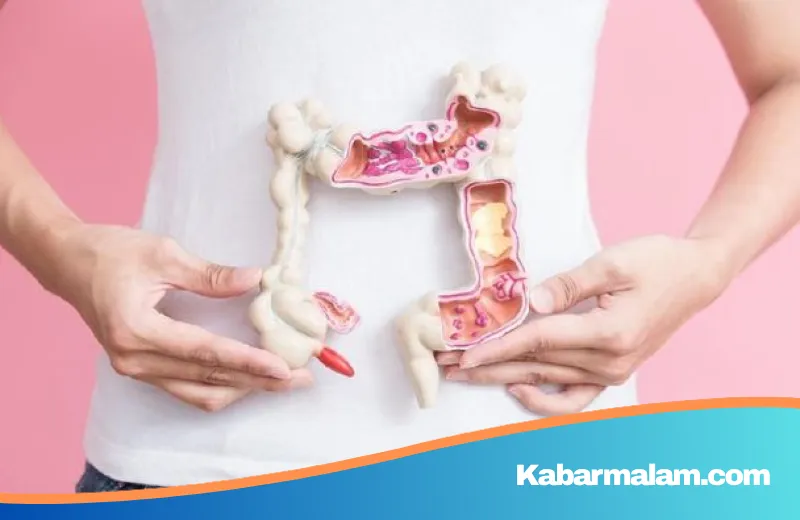 Bukan Lagi Penyakit Lansia: Waspadai 4 Sinyal Bahaya Kanker Usus di Usia Muda