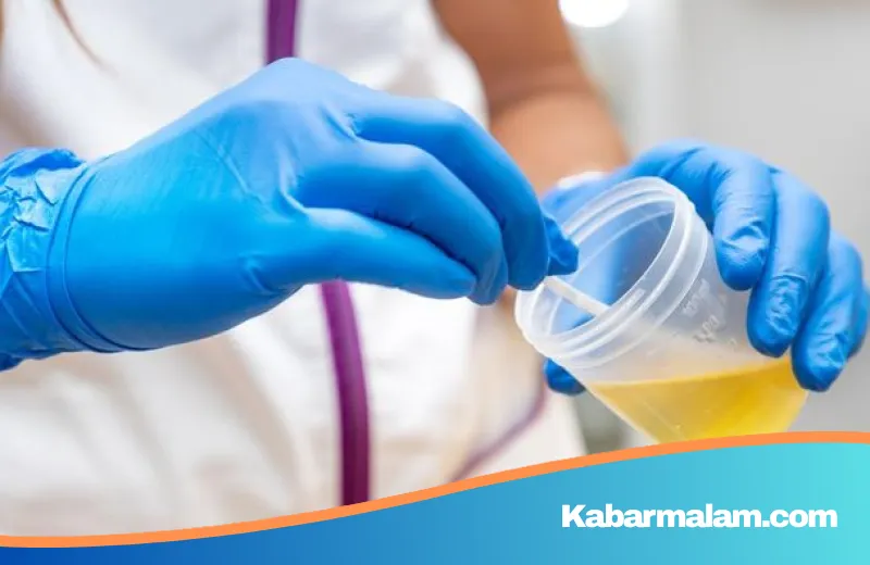 Deteksi Dini Kerusakan Ginjal Melalui Perubahan Urine, Kenali Tanda-Tandanya Sebelum Terlambat