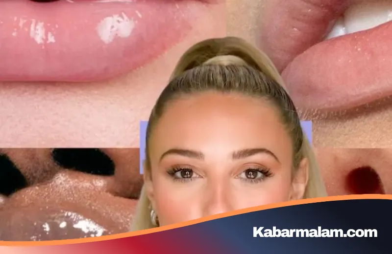Gym Lips: Rahasia di Balik Tampilan Bibir Plumpy yang Effortless dan Alami