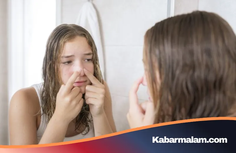 Jangan Sembarangan! Ini Alasan Medis Mengapa Jerawat di Bawah Hidung Tidak Boleh Dipencet