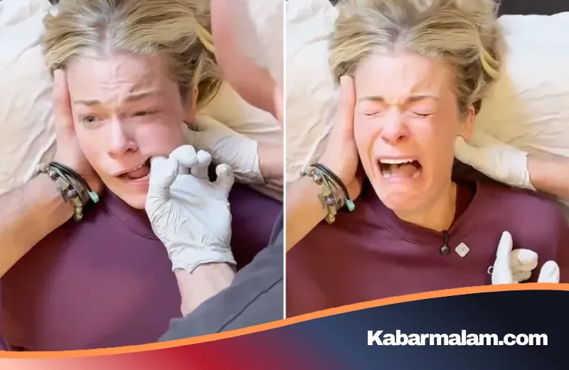 Mengapa Terapi Rahang Bisa Bikin Menangis Histeris? Menguak Rahasia Deep Jaw Release yang Tengah Viral
