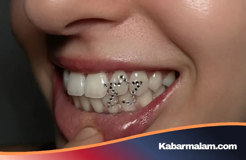 Senyum Berkilau ala Karakter Game: Fenomena Tooth Gem yang Kini Menginvasi Tren Kecantikan Gen Z
