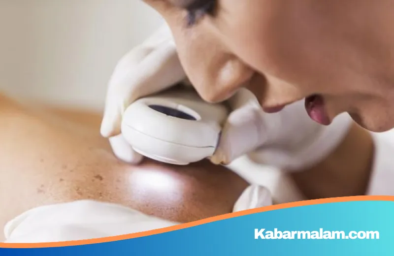 Waspada Sinyal Bahaya dari Kulit: Kenali Gejala Kanker Darah yang Sering Terabaikan