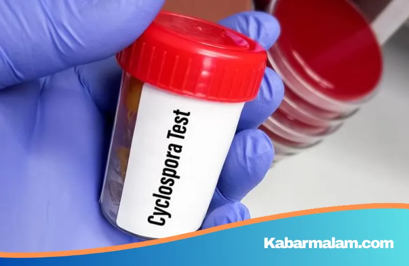 AS Terpungung Wabah Parasit Cyclospora, Ratusan Orang Alami Diare 'Eksplosif' di 18 Negara Bagian